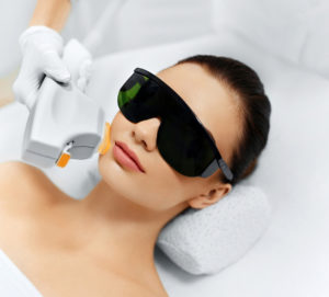 laser hair removal patient