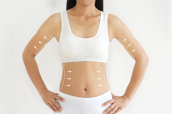 Effective Non Surgical Body Contouring Options