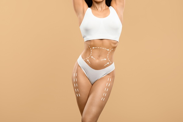 Get Rid Of Loose Skin With Body Contouring